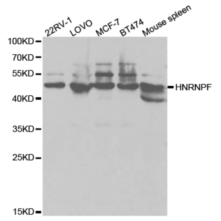 Anti-hnRNP F Antibody from Bioworld Technology (BS7133) - Antibodies.com