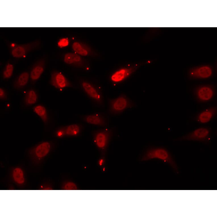 Anti-hnRNP F Antibody from Bioworld Technology (BS7133) - Antibodies.com