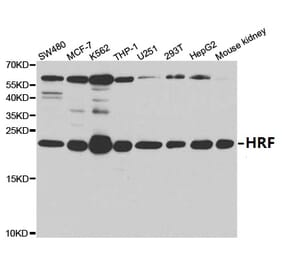 Anti-HRF Antibody from Bioworld Technology (BS7134) - Antibodies.com