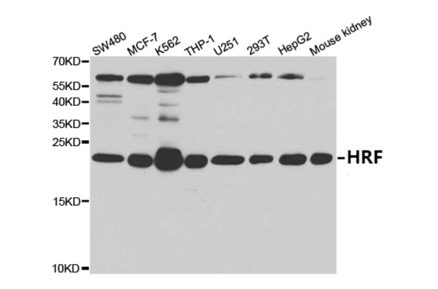 Anti-HRF Antibody from Bioworld Technology (BS7134) - Antibodies.com