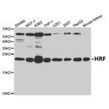 Anti-HRF Antibody from Bioworld Technology (BS7134) - Antibodies.com