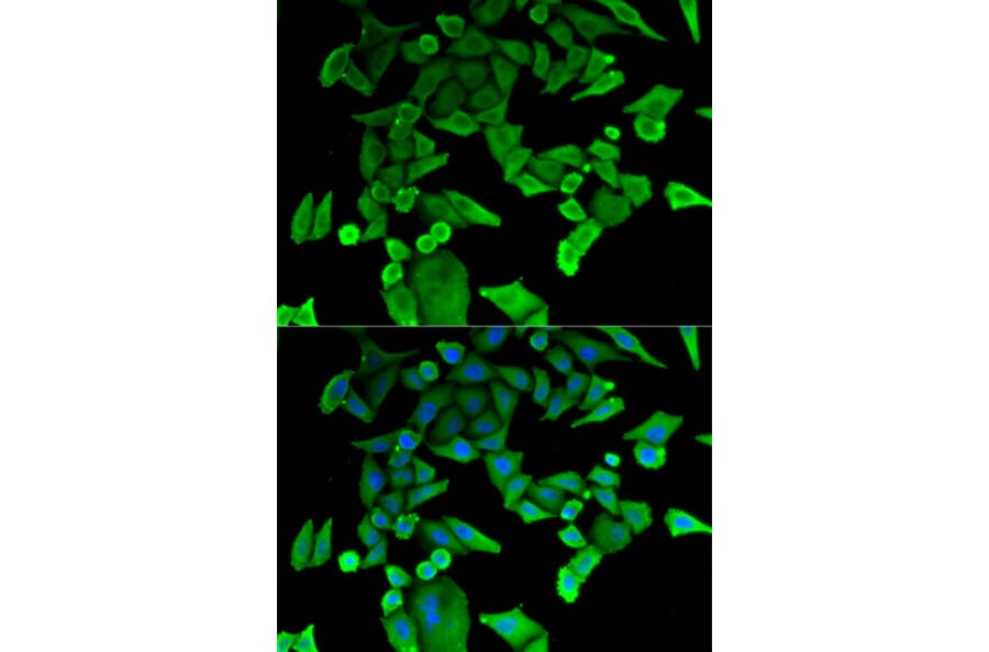 Anti-HRF Antibody from Bioworld Technology (BS7134) - Antibodies.com