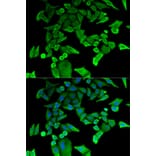 Anti-HRF Antibody from Bioworld Technology (BS7134) - Antibodies.com