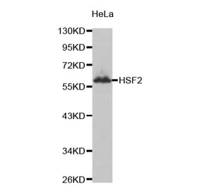 Anti-HSF2 Antibody from Bioworld Technology (BS7136) - Antibodies.com