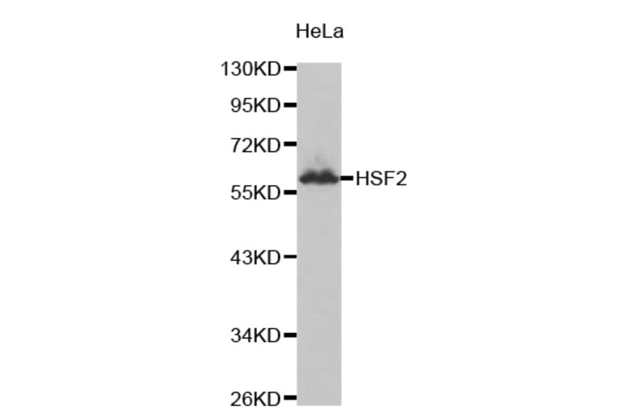 Anti-HSF2 Antibody from Bioworld Technology (BS7136) - Antibodies.com