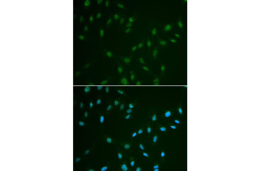 Anti-HSF2 Antibody from Bioworld Technology (BS7136) - Antibodies.com