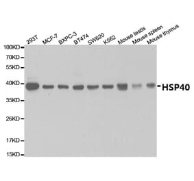 Anti-HSP40 Antibody from Bioworld Technology (BS7137) - Antibodies.com