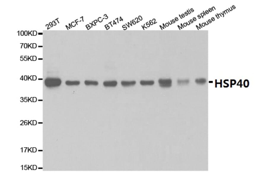 Anti-HSP40 Antibody from Bioworld Technology (BS7137) - Antibodies.com