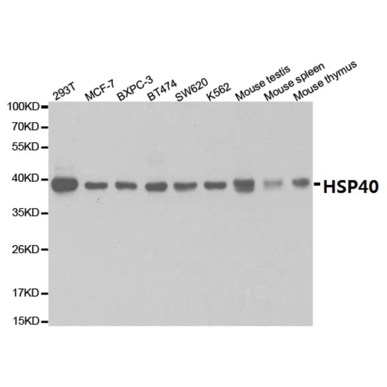 Anti-HSP40 Antibody from Bioworld Technology (BS7137) - Antibodies.com