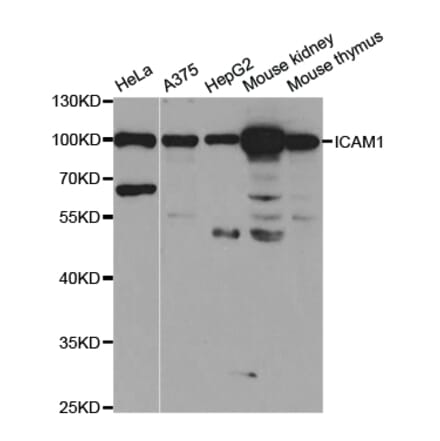 Anti-ICAM-1 Antibody from Bioworld Technology (BS7138) - Antibodies.com
