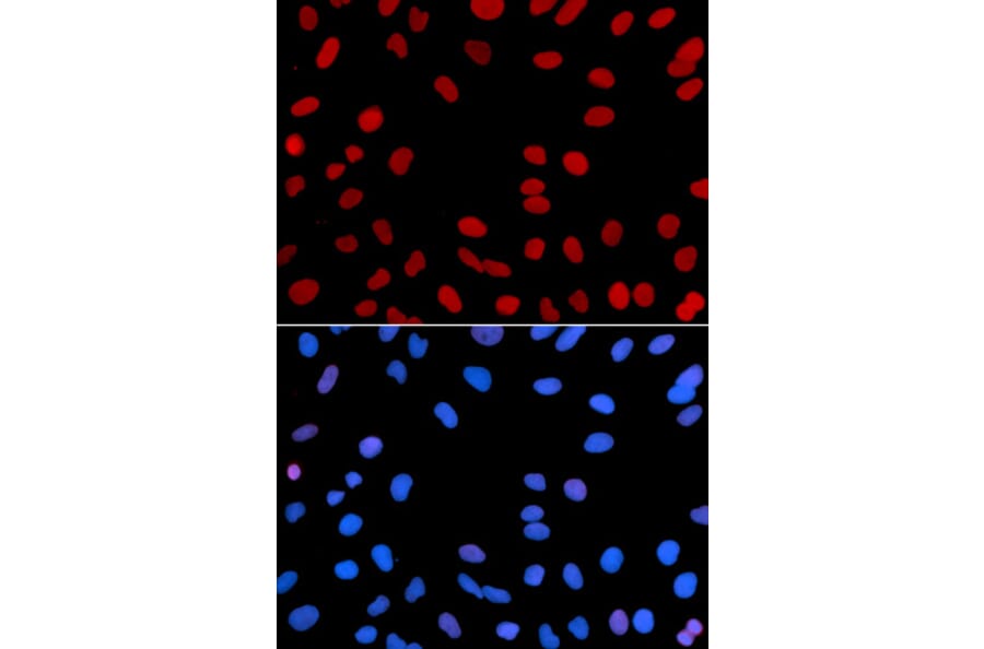 Anti-IFI-16 Antibody from Bioworld Technology (BS7139) - Antibodies.com