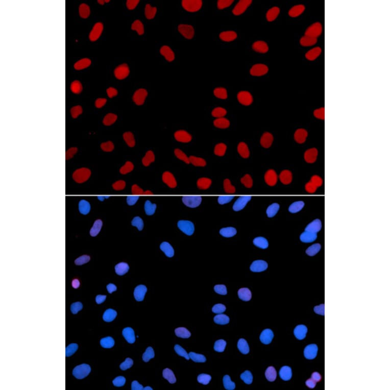 Anti-IFI-16 Antibody from Bioworld Technology (BS7139) - Antibodies.com
