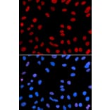Anti-IFI-16 Antibody from Bioworld Technology (BS7139) - Antibodies.com