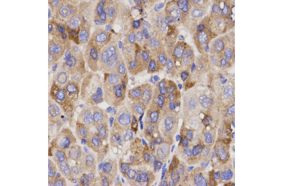 Anti-IFN-R1 Antibody from Bioworld Technology (BS7140) - Antibodies.com