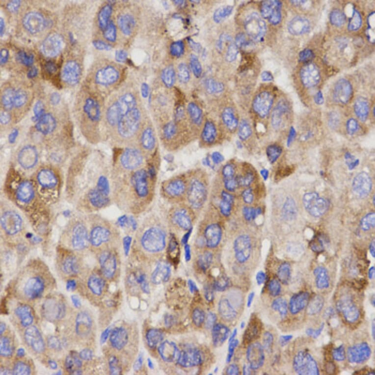 Anti-IFN-R1 Antibody from Bioworld Technology (BS7140) - Antibodies.com