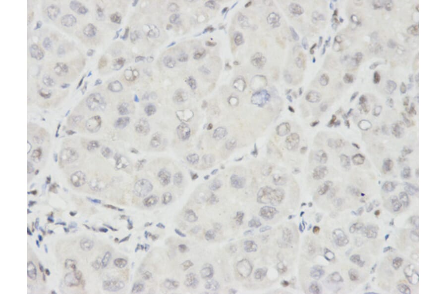 Anti-Ikaros Antibody from Bioworld Technology (BS7141) - Antibodies.com