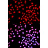 Anti-Ikaros Antibody from Bioworld Technology (BS7141) - Antibodies.com