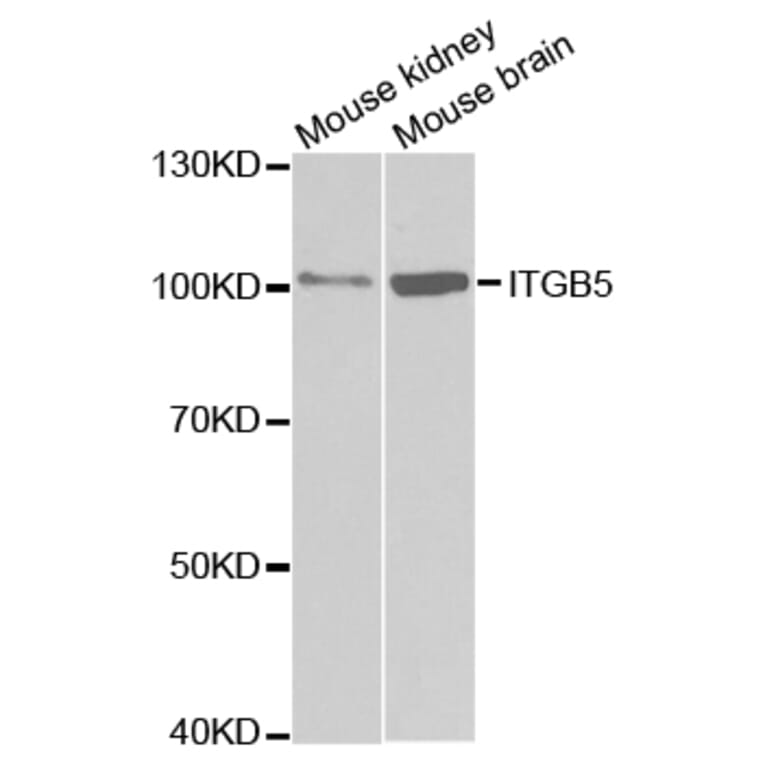 Anti-Integrin β5 Antibody from Bioworld Technology (BS7147) - Antibodies.com