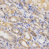 Anti-Integrin β5 Antibody from Bioworld Technology (BS7147) - Antibodies.com