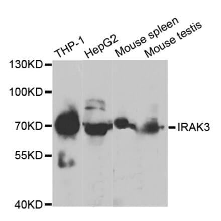 Anti-IRAK-M Antibody from Bioworld Technology (BS7148) - Antibodies.com
