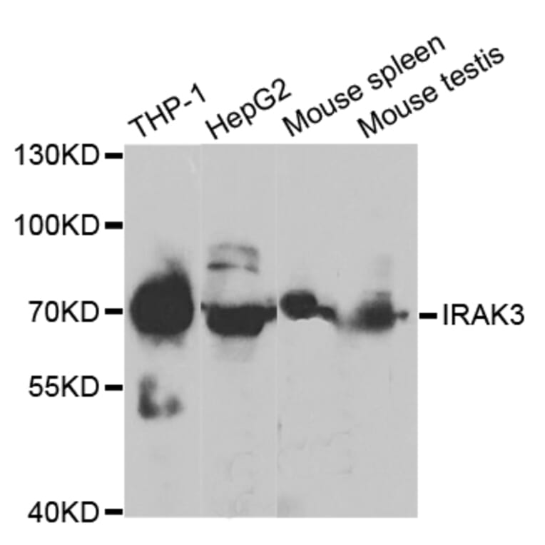 Anti-IRAK-M Antibody from Bioworld Technology (BS7148) - Antibodies.com