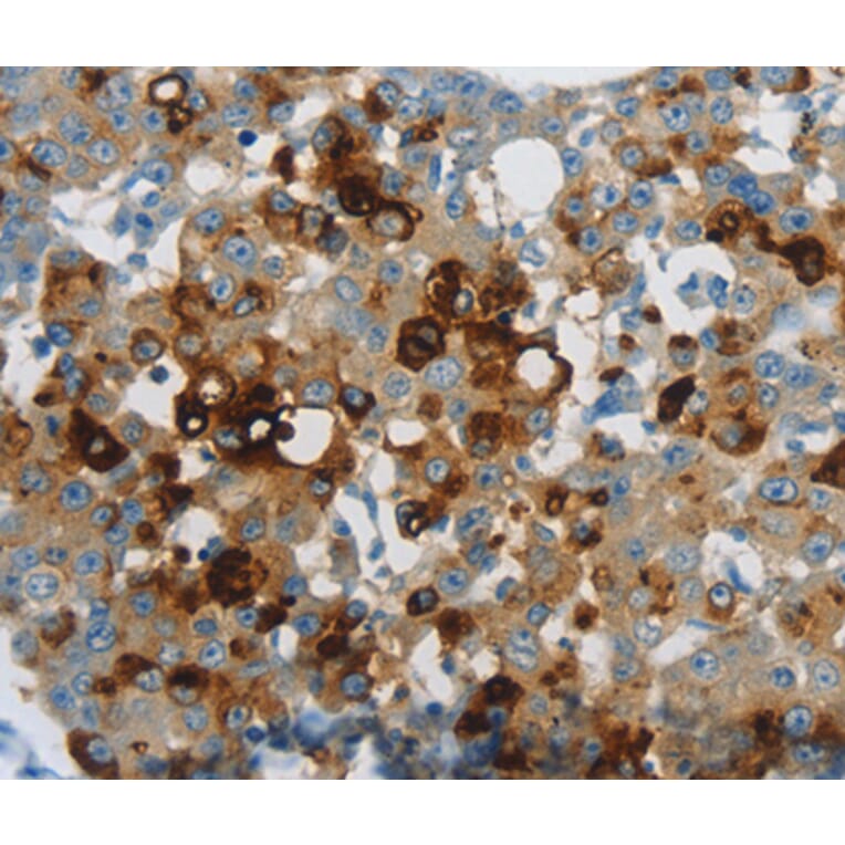 Anti-LCN2 Antibody from Bioworld Technology (BS7150) - Antibodies.com