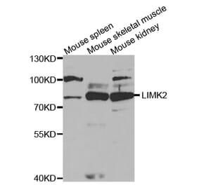 Anti-LIMK2 Antibody from Bioworld Technology (BS7151) - Antibodies.com