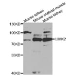 Anti-LIMK2 Antibody from Bioworld Technology (BS7151) - Antibodies.com