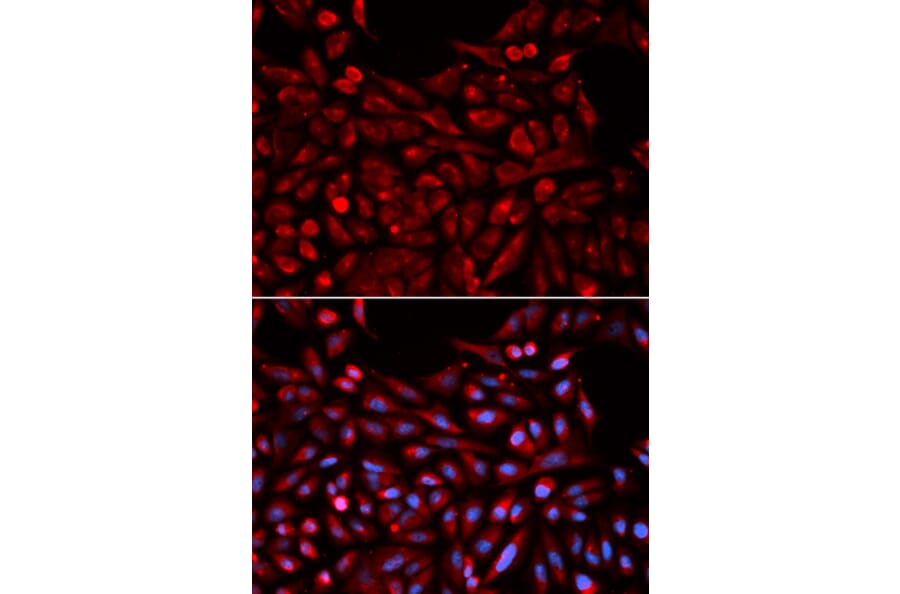 Anti-MB67 Antibody from Bioworld Technology (BS7155) - Antibodies.com