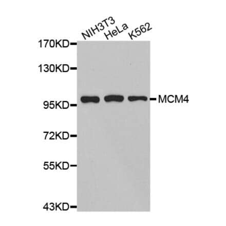 Anti-MCM4 Antibody from Bioworld Technology (BS7158) - Antibodies.com