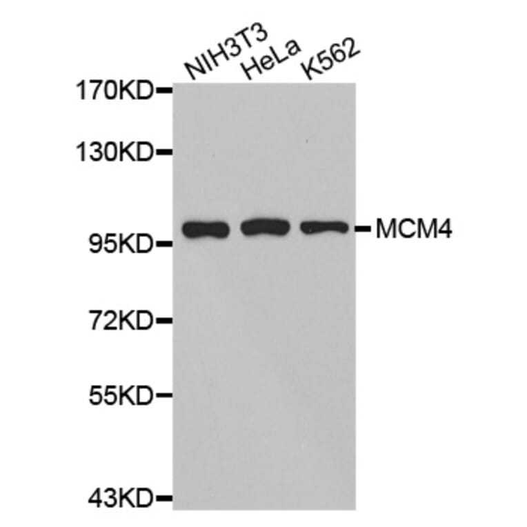 Anti-MCM4 Antibody from Bioworld Technology (BS7158) - Antibodies.com