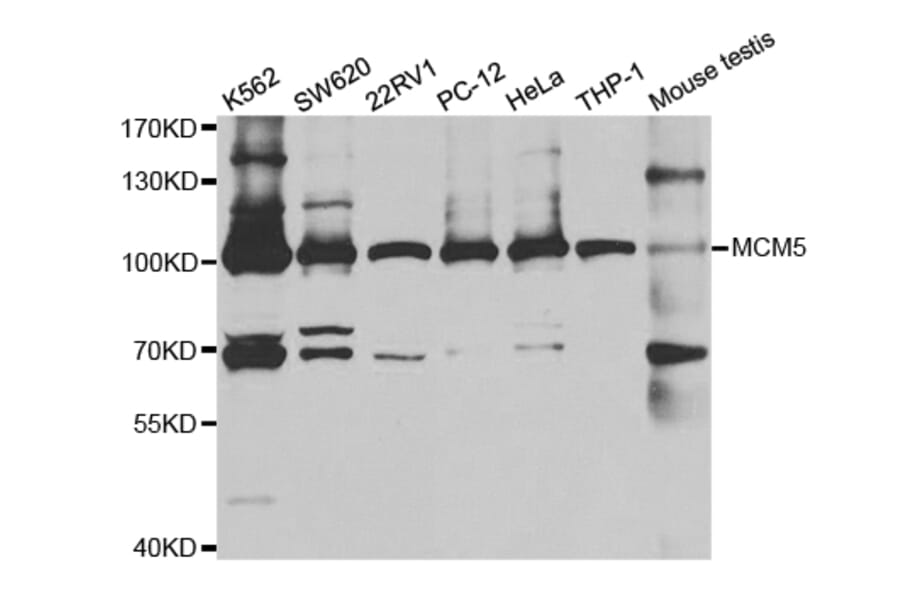 Anti-MCM5 Antibody from Bioworld Technology (BS7159) - Antibodies.com