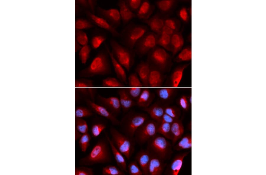 Anti-MCM5 Antibody from Bioworld Technology (BS7159) - Antibodies.com