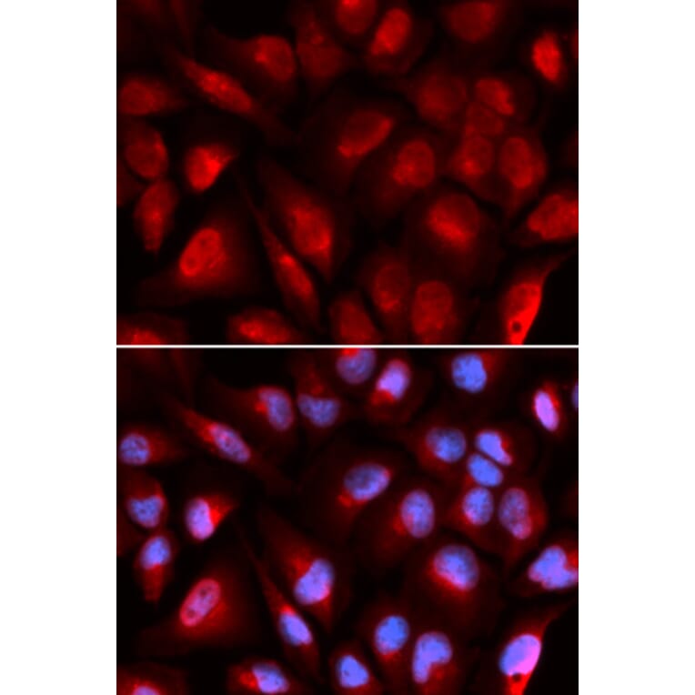 Anti-MCM5 Antibody from Bioworld Technology (BS7159) - Antibodies.com