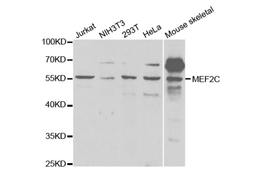 Anti-MEF2C Antibody from Bioworld Technology (BS7160) - Antibodies.com