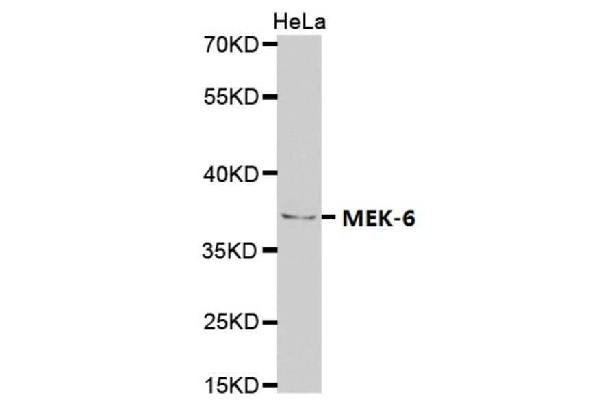 Anti-MEK-6 Antibody from Bioworld Technology (BS7161) - Antibodies.com
