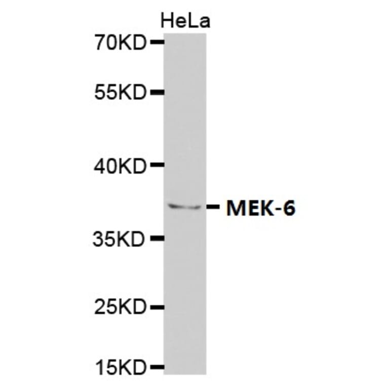 Anti-MEK-6 Antibody from Bioworld Technology (BS7161) - Antibodies.com