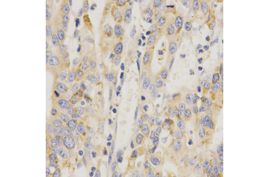 Anti-MEK-6 Antibody from Bioworld Technology (BS7161) - Antibodies.com