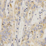 Anti-MEK-6 Antibody from Bioworld Technology (BS7161) - Antibodies.com