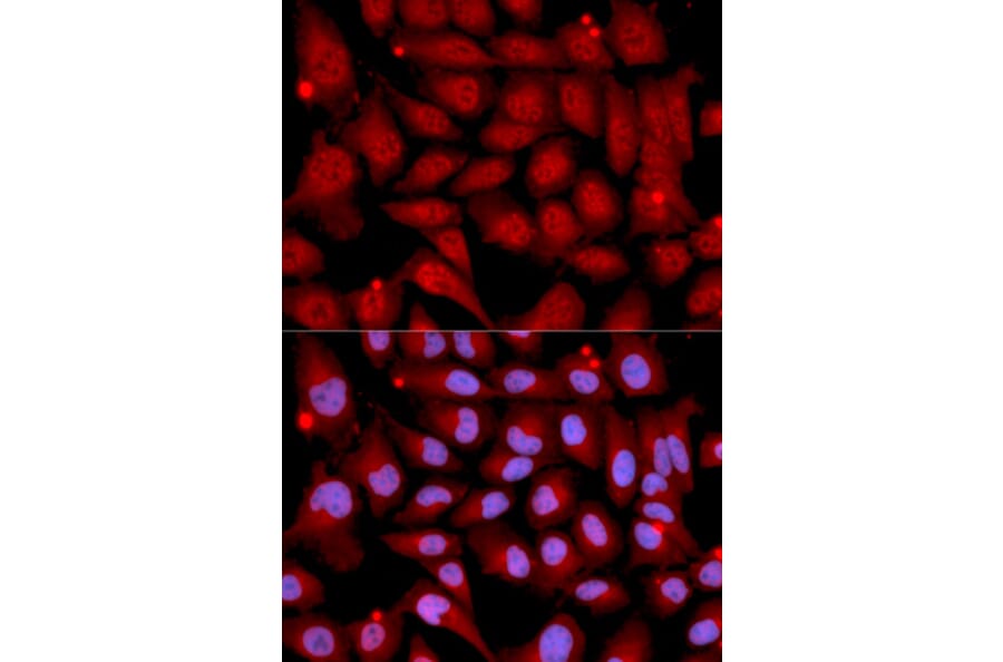 Anti-MEK-6 Antibody from Bioworld Technology (BS7161) - Antibodies.com