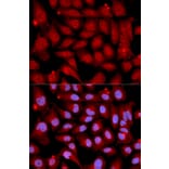 Anti-MEK-6 Antibody from Bioworld Technology (BS7161) - Antibodies.com