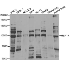 Anti-MerTK Antibody from Bioworld Technology (BS7162) - Antibodies.com