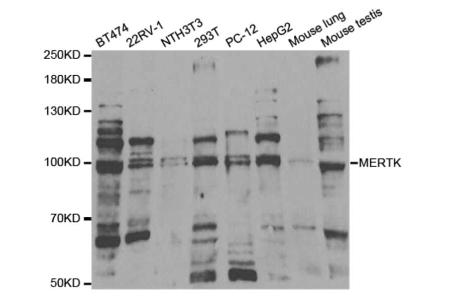 Anti-MerTK Antibody from Bioworld Technology (BS7162) - Antibodies.com