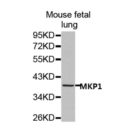 Anti-MKP1 Antibody from Bioworld Technology (BS7166) - Antibodies.com