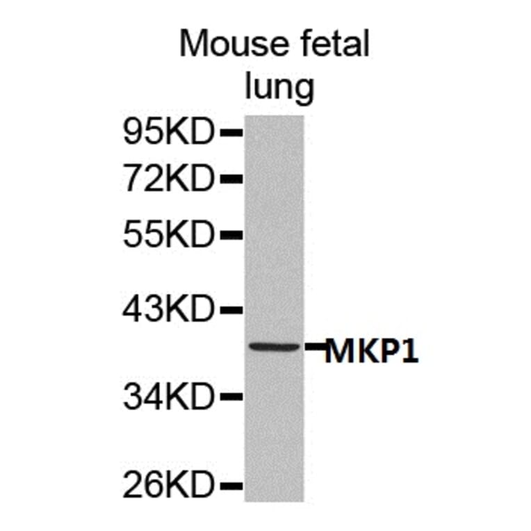 Anti-MKP1 Antibody from Bioworld Technology (BS7166) - Antibodies.com