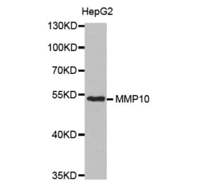 Anti-MMP-10 Antibody from Bioworld Technology (BS7167) - Antibodies.com