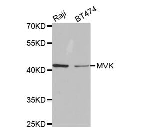 Anti-MVK Antibody from Bioworld Technology (BS7172) - Antibodies.com