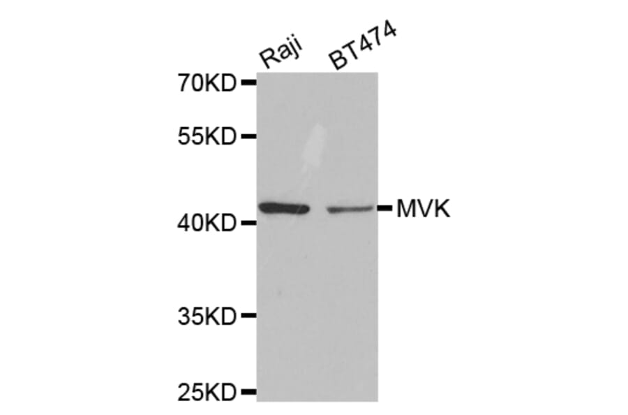 Anti-MVK Antibody from Bioworld Technology (BS7172) - Antibodies.com