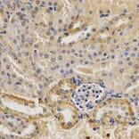 Anti-MVK Antibody from Bioworld Technology (BS7172) - Antibodies.com