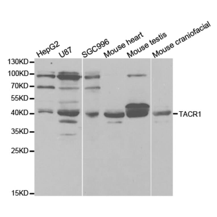 Anti-NK-1R Antibody from Bioworld Technology (BS7176) - Antibodies.com